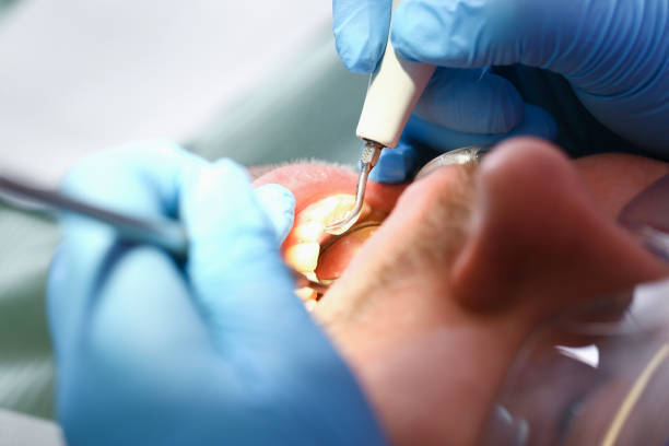 Best Emergency Orthodontic Repairs in Beaufort, SC
