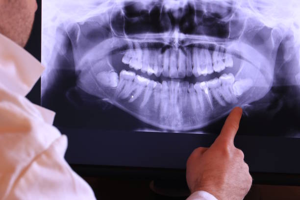 Best Walk-In Emergency Dentist in Beaufort, SC